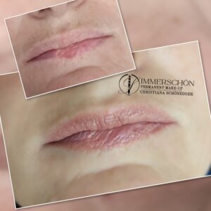 Permanent Make-Up Lippen Narben Korrektur, abgeheilt