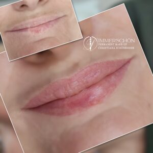 Permanent Make-Up Lippen Narben Korrektur