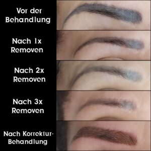 Permanent Make-Up Entfernung/Remover mit Korregtur